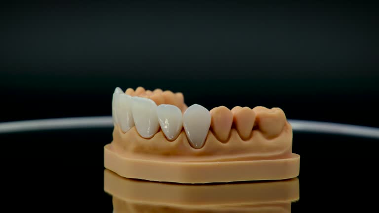 Best Dental Inlays and Onlays  in USA